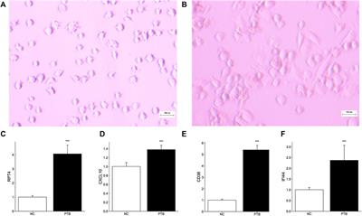 Integrated bioinformatic analyses investigate macrophage-M1-related biomarkers and tuberculosis therapeutic drugs